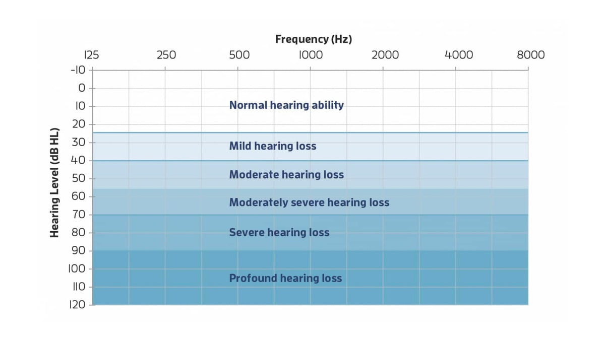 Sound Spectrum Ear Hearing Loss Doesn't Mean Deafness: Understanding the Spectrum of Hear ...